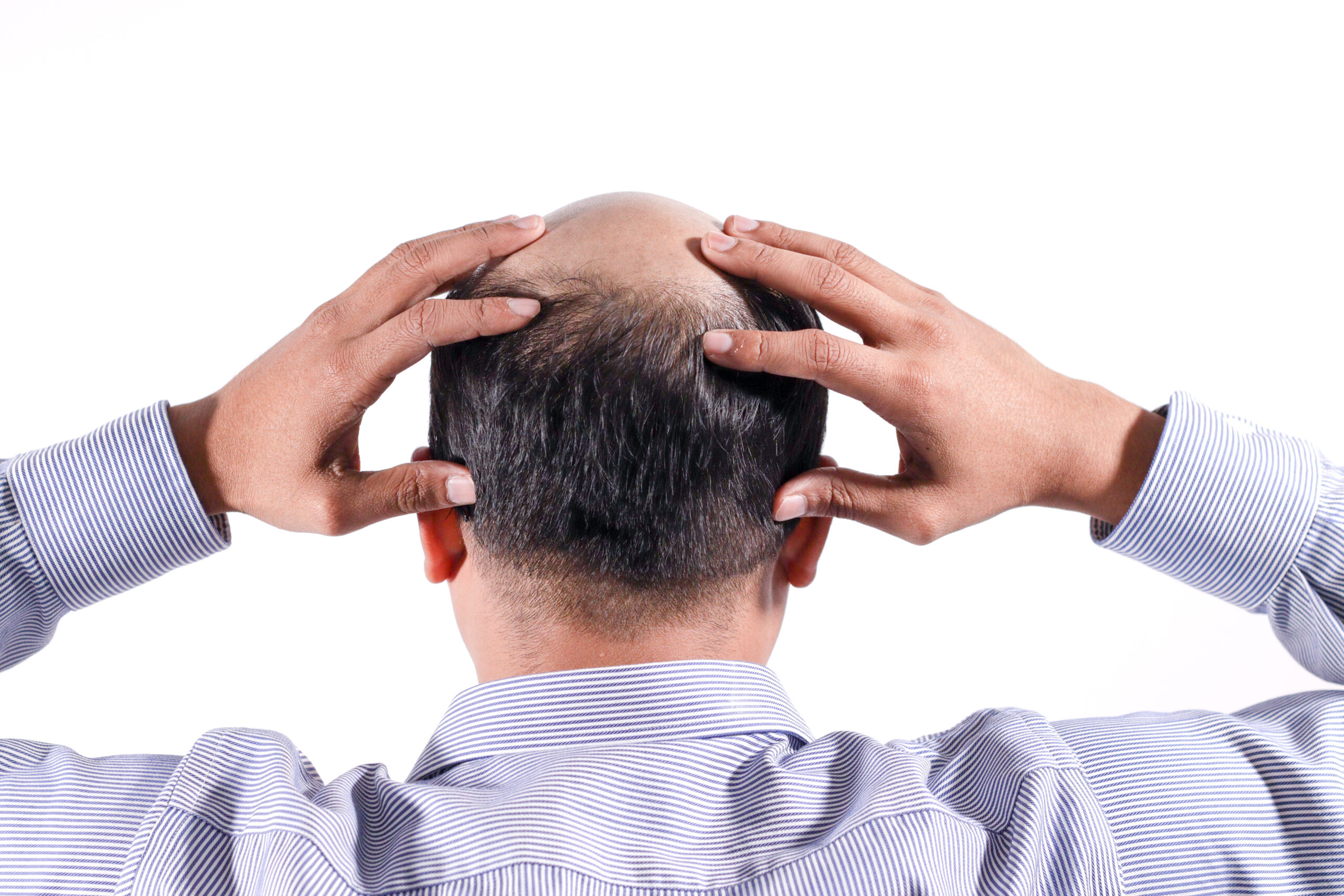 bald businessman with his head on scalp view from behind with white background
